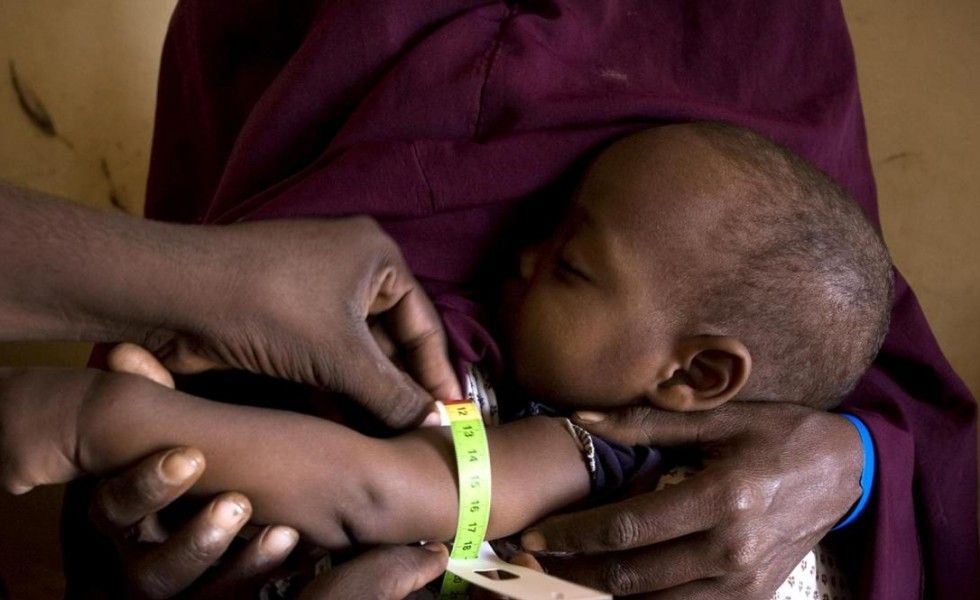 bebe_con_desnutricion_en_cuerno_de_africa